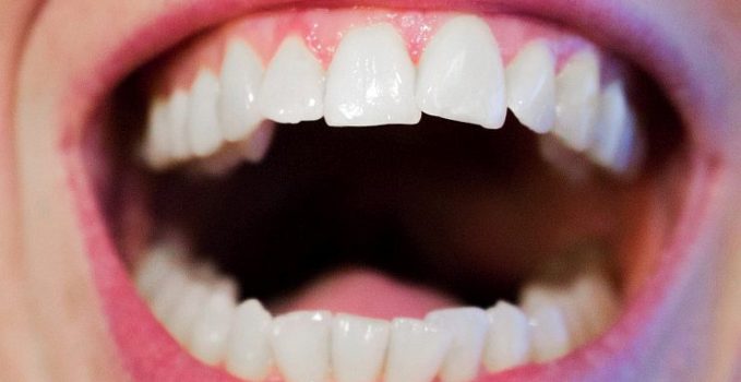 denti